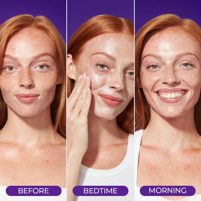 Overnight Sensation™ Hydrating Sleep Mask